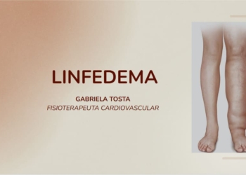 7 – Tudo sobre Linfedema