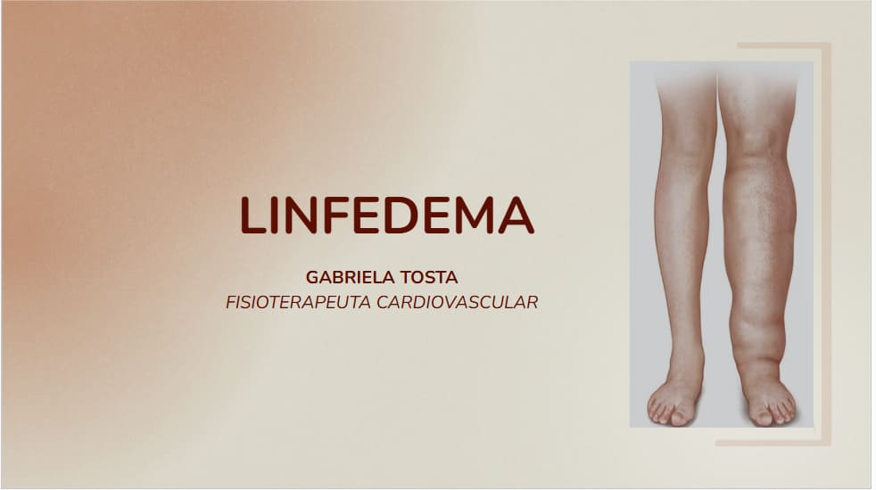 7 – Tudo sobre Linfedema