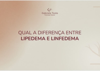 4 – Diferenças entre o Lipedema e Linfedema